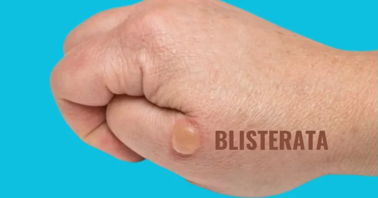 Blisterata: An In-Depth Exploration